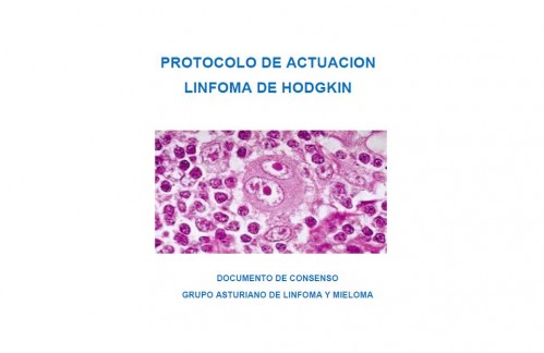 Edición protocolo de actuación en Linfoma de Hodgkin